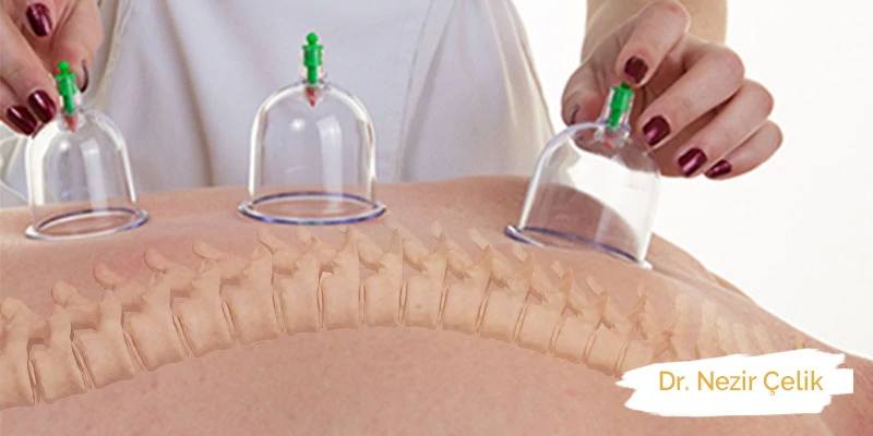 Hacamat ile Fıtık Tedavisi